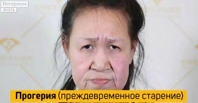 Из бабушки снова в девочку. Пластические хирурги подарили 15-летней героини надежду на светлое будущее - interesnoznat.com