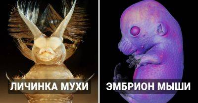 18 крутых макрофото разных лет, которые сделали участники «Nikon Small World», показав невидимый живой мир - twizz.ru