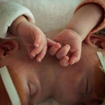 Второй шанс: что получили на первый день рождения сиамские близнецы из США - clutch.net.ua - Сша