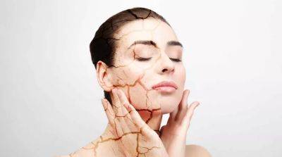 8 способов бороться с сухой кожей - beauty-lady.com.ua