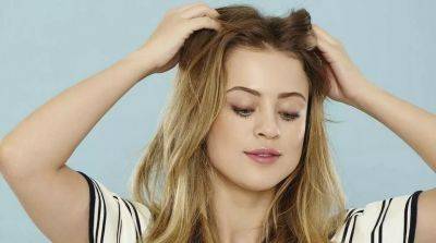 5 простых способов борьбы с перхотью - beauty-lady.com.ua