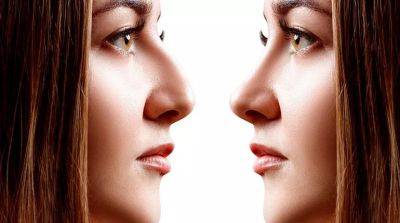 Можно ли исправить форму носа без операций? - beauty-lady.com.ua
