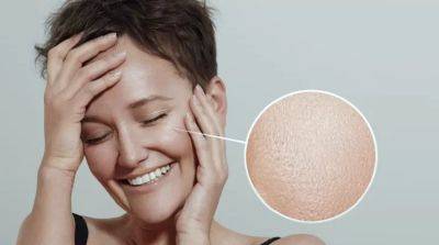 Жирная кожа: причины и как с этим бороться - beauty-lady.com.ua