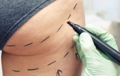 Эта косметологическая процедура убивает 1 из 4000 женщин: молодая британка умерла из-за бразильской подтяжки ягодиц (ФОТО) - hochu.ua - Англия - Турция - Стамбул
