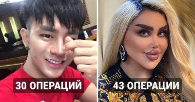 10 случаев, когда люди прошли через рекордное количество операций, чтобы получить внешность своей мечты - twizz.ru - Швеция - Иран - Буэнос-Айрес